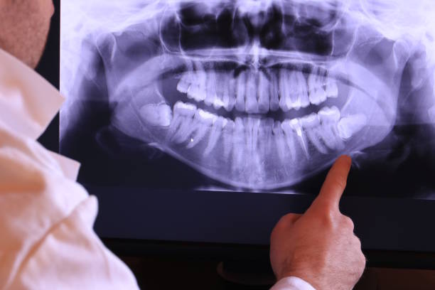 Best Pediatric Emergency Dentist in Ciborne, LA