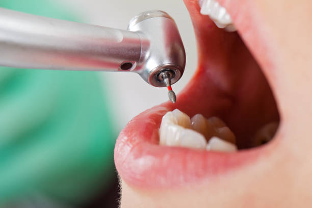 Best Urgent Dental Care in Ciborne, LA